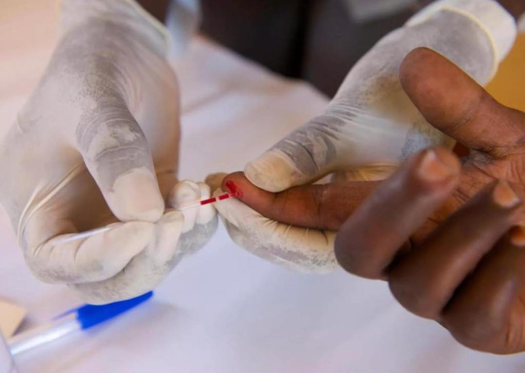 Teste gratuito de HIV/AIDS e DST disponível no Centro Médico do&nbsp;Rangel